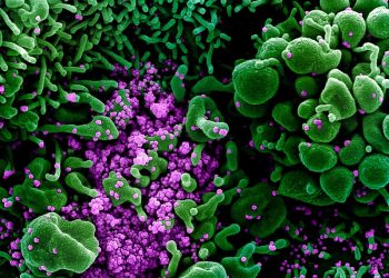 ارتفاع عدد حالات كوفيد-19 المؤكدة في أفريقيا إلى ما يزيد عن 10000 حالة