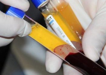 دار الإفتاء تطلق مبادرة “ومن أحياها” لحث المتعافين من فيروس كورونا على التبرع ببلازما الدم لعلاج المصابين