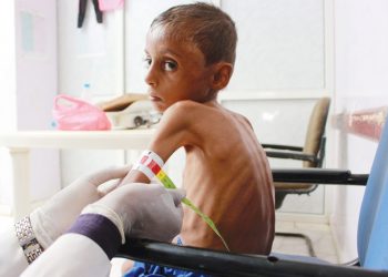 الأمم المتحدة:1.2مليون يمني إضافى قد يفقدون غذائهم خلال ستة أشهر