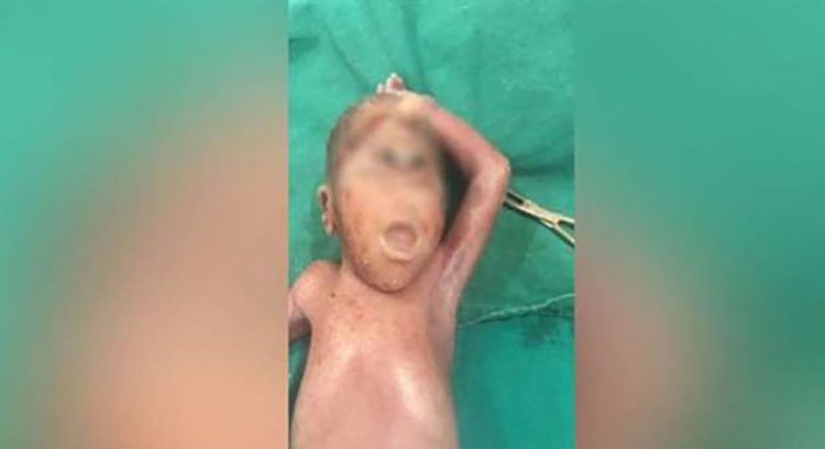 مولد طفل بعين واحدة في الأقصر تطلق ترند المسيح الدجال 1 مولد طفل بعين واحدة في الأقصر تطلق ترند المسيح الدجال