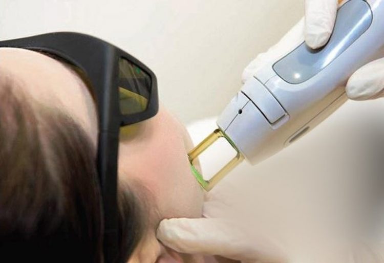 جلسة علاج بالليزر تصيب فتاة بحروق متفرقة في أنحاء جسمها 1 جلسة علاج بالليزر تصيب فتاة بحروق متفرقة في أنحاء جسمها