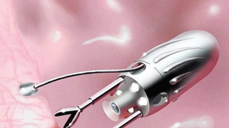 روبوت متناهي الصغر يزيل الملوثات الهرمونية من السوائل