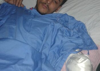 بلطجي بالمحله يستعين بثلاث بلطجيه للتعدي علي شاب وبتر زراعه بسيف وسرقته بالإكراه