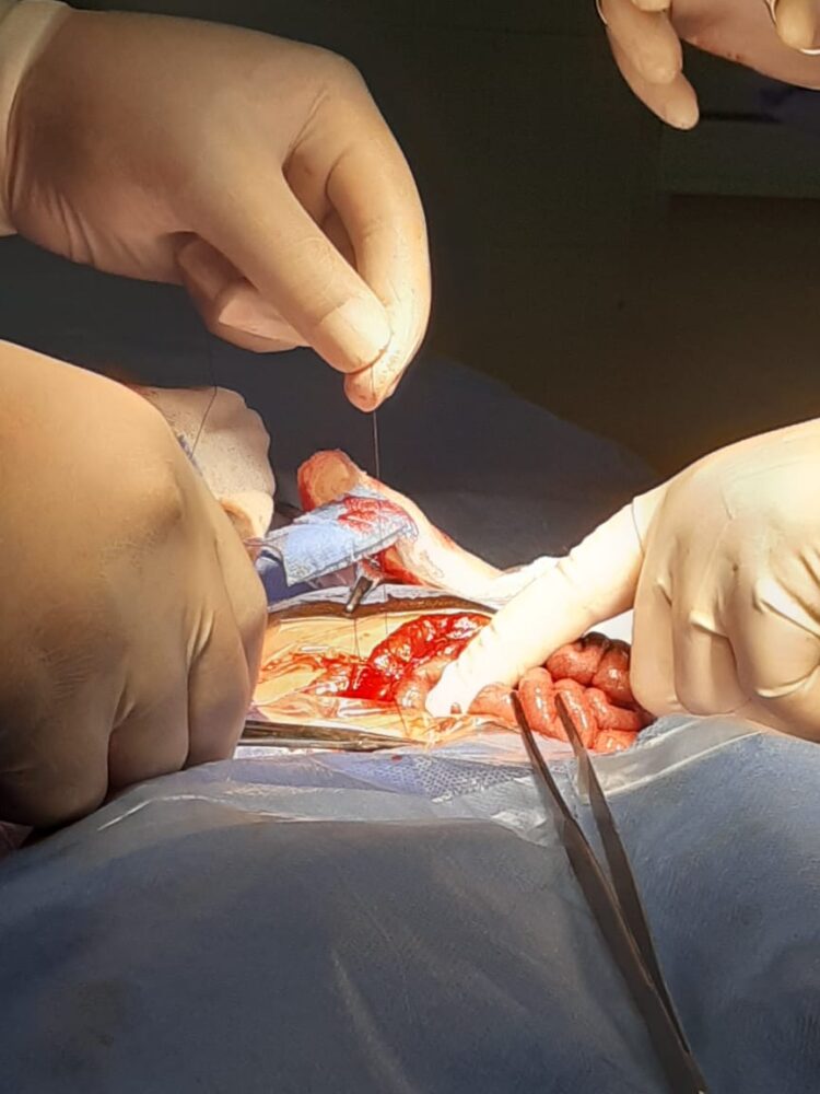 للمرة الأولى بـأجا المركزى فريق طبي ينجح في إجراء عملية انسداد معوي لطفلة عمرها ه أيام 1 للمرة الأولى بـأجا المركزى فريق طبي ينجح في إجراء عملية انسداد معوي لطفلة عمرها ه أيام