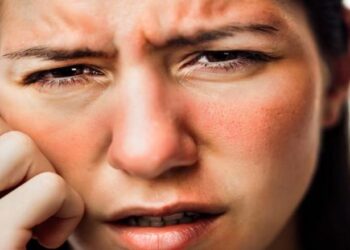 التسمم الشمسى حالة تنتج من شدة حروق الشمس… الأعراض وطرق الوقاية