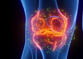 7 نصائح للوقاية من هشاشة العظام